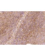 Anti-B7-H3 Antibody, Rabbit Polyclonal sinobiological 11188-T24