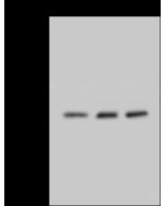 Anti-Claudin18 Antibody, Rabbit Polyclonal sinobiological 200116-T32