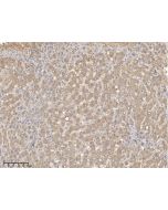Anti-ACSS3 Antibody, Rabbit Polyclonal sinobiological 110930-T08