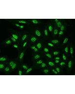 Anti-C6orf226 Antibody, Rabbit Polyclonal sinobiological 204598-T02