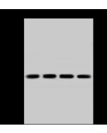 Anti-CacyBP Antibody, Rabbit Polyclonal sinobiological 203518-T46