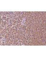 Anti-DNAJB14 Antibody, Rabbit Polyclonal sinobiological 202489-T08