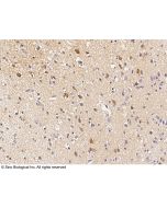 Anti-CaMKII alpha/CAMK2A Antibody, Rabbit Polyclonal sinobiological 100866-T08