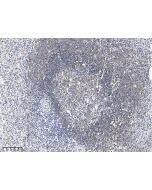 Anti-CD19 Antibody, Mouse Monoclonal sinobiological 110203-M054