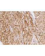 Anti-Calponin/CNN1 Antibody, Rabbit Polyclonal sinobiological 204031-T08