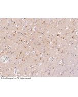 Anti-MAP1LC3A Antibody, Rabbit Polyclonal sinobiological 14322-T44