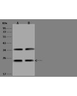 Anti-COMMD9 Antibody, Rabbit Polyclonal sinobiological 201455-T36