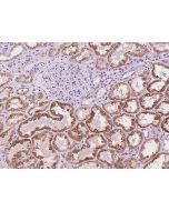 Anti-CLEC14A Antibody, Rabbit Polyclonal sinobiological 201788-T08