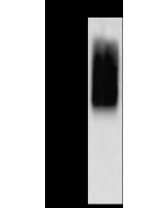 Human metapneumovirus (strain HMPV/Homo sapiens/PER/CFI0466/2010/B) glycoprotein G Antibody, Rabbit PAb, Antigen Affinity Purified sinobiological 40798-T62