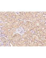 Anti-BEND7 Antibody, Rabbit Polyclonal sinobiological 205690-T08