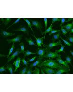 Anti-Beta-2 microglobulin Antibody, Mouse Monoclonal sinobiological 11976-MM29