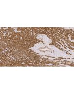 Anti-Human Desmin Antibody, Mouse MAb sinobiological IHC031