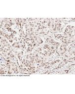 Anti-CHD4 Antibody, Rabbit Polyclonal sinobiological 102312-T10