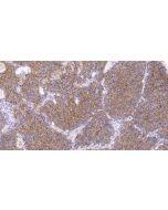 Anti-Human PD-L1/B7-H1 Antibody, Mouse MAb sinobiological IHC062