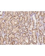 Anti-HMGCL Antibody, Rabbit Polyclonal sinobiological 204320-T10