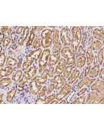 Anti-AKAP10 Antibody, Rabbit Polyclonal sinobiological 203321-T08