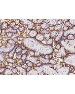 Anti-Alkaline phosphatase/APLI Antibody, Rabbit Polyclonal sinobiological 203001-T08