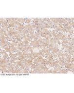 Anti-HTRA3 Antibody, Rabbit Polyclonal sinobiological 102513-T08