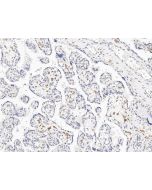 Anti-CD163 Antibody, Rabbit Polyclonal sinobiological 100473-T08