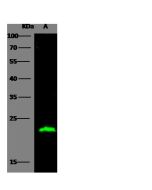 Anti-CD3 epsilon/CD3e Antibody, Rabbit Polyclonal sinobiological 100216-T32