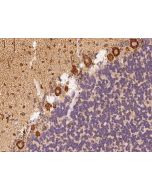 Anti-CHD5 Antibody, Rabbit Polyclonal sinobiological 205693-T10