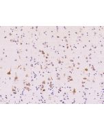 Anti-ABI2 Antibody, Rabbit Polyclonal sinobiological 105134-T10