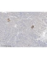 Recombinant Anti-GCG/Glucagon Antibody, Rabbit Monoclonal sinobiological 110122-R060