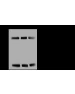 Anti-FABP5 Antibody, Rabbit Polyclonal sinobiological 12581-T20