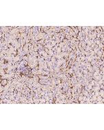 Anti-ICAM-1/CD54 Antibody, Rabbit Polyclonal sinobiological 50440-T24