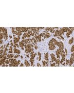 Anti-Human Androgen receptor Antibody, Mouse MAb sinobiological IHC092