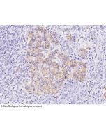 Anti-CXCL5 Antibody, Rabbit Polyclonal sinobiological 10889-T24
