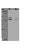 Anti-ALS2CR12 Antibody, Rabbit Polyclonal sinobiological 204517-T34