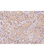 Anti-AKAP18/AKAP7 Antibody, Rabbit Polyclonal sinobiological 201899-T08