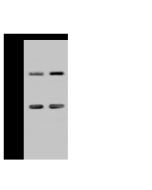 Anti-ADNP Antibody, Rabbit Polyclonal sinobiological 203059-T38