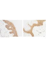 Anti-beta-Catenin Antibody, Rabbit Polyclonal sinobiological 11279-RP02