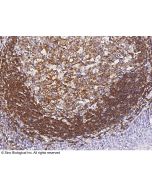 Anti-Siglec-2/CD22 Antibody, Mouse Monoclonal sinobiological 11958-MM12