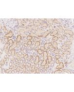 Anti-FER1L6 Antibody, Rabbit Polyclonal sinobiological 206100-T08