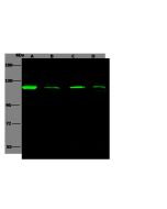 Anti-AP2A2 Antibody, Rabbit Polyclonal sinobiological 103439-T32