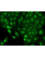 Anti-DPF2 Antibody, Rabbit Polyclonal sinobiological 203094-T02