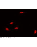 Anti-DNMT1 Antibody, Rabbit Polyclonal sinobiological 100780-T10
