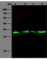 Recombinant Anti-Galectin-3/LGALS3 Antibody, Rabbit Monoclonal sinobiological 10289-R078