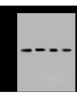 Anti-AKR1B1 Antibody, Rabbit Polyclonal sinobiological 202655-T36
