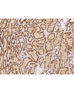 Anti-DHX29 Antibody, Rabbit Polyclonal sinobiological 208957-T10