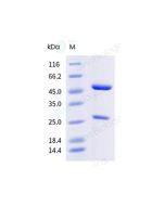 Anti-HMPV-F (Research Grade Clone MPV458) sinobiological 68251-H001A