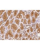Anti-ARL3 Antibody, Rabbit Polyclonal sinobiological 201563-T08