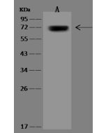 Anti-GBP1 Antibody, Rabbit Polyclonal sinobiological 310514-T36