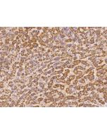 Anti-DPH5 Antibody, Rabbit Polyclonal sinobiological 200310-T08