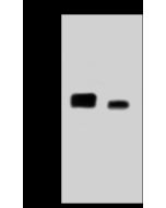 Anti-LAT Antibody, Rabbit Polyclonal sinobiological 12094-T36