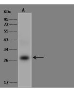 Anti-EIF6 Antibody, Rabbit Polyclonal sinobiological 204022-T44