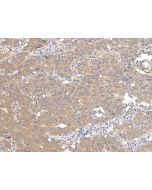 Anti-AKT1S1/PRAS40 Antibody, Rabbit Polyclonal sinobiological 109889-T08